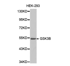 Western blot - GSK3B antibody from Signalway Antibody (38353) - Antibodies.com