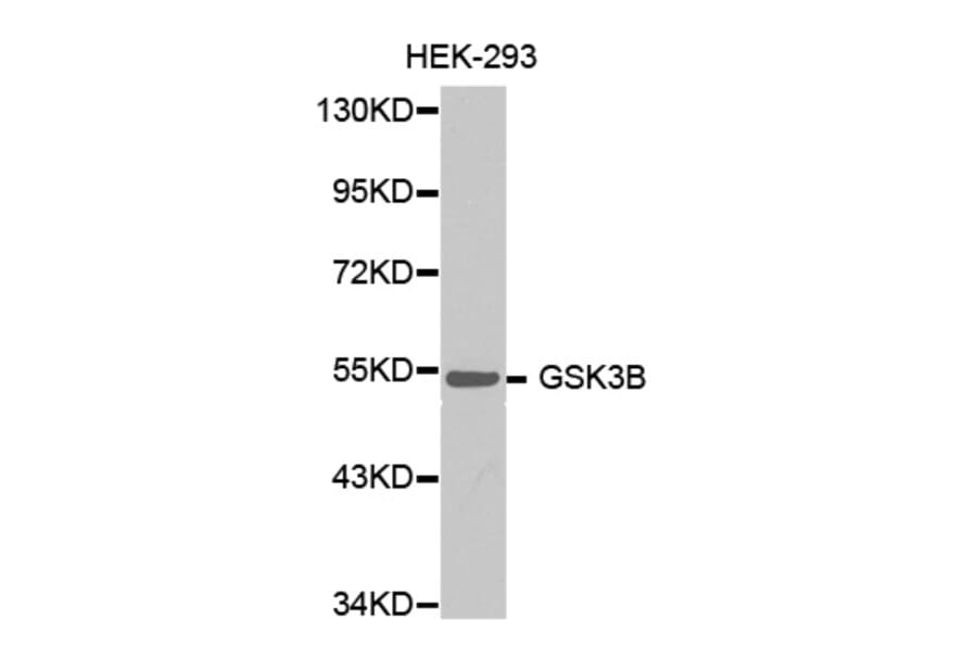 Western blot - GSK3B antibody from Signalway Antibody (38353) - Antibodies.com