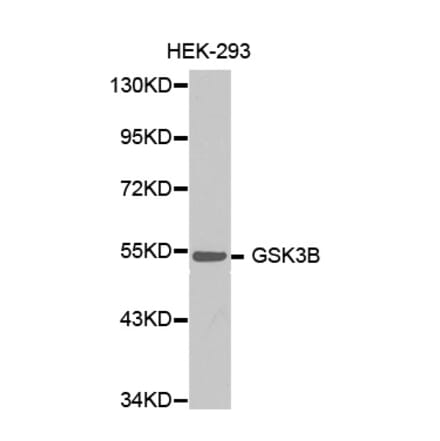 Western blot - GSK3B antibody from Signalway Antibody (38353) - Antibodies.com