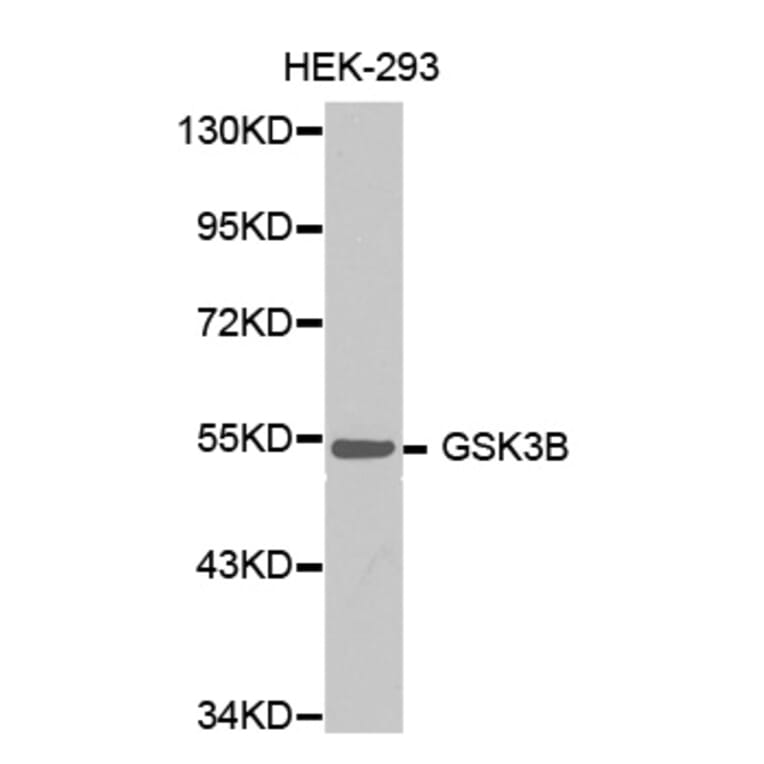 Western blot - GSK3B antibody from Signalway Antibody (38353) - Antibodies.com