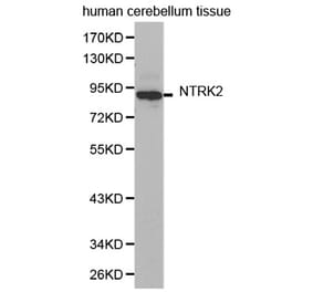 Western blot - NTRK2 antibody from Signalway Antibody (38362) - Antibodies.com