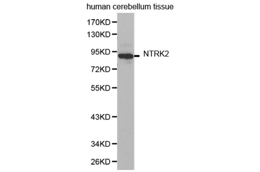 Western blot - NTRK2 antibody from Signalway Antibody (38362) - Antibodies.com
