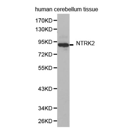 Western blot - NTRK2 antibody from Signalway Antibody (38362) - Antibodies.com