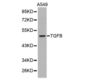 Western blot - TGFB1 antibody from Signalway Antibody (38371) - Antibodies.com