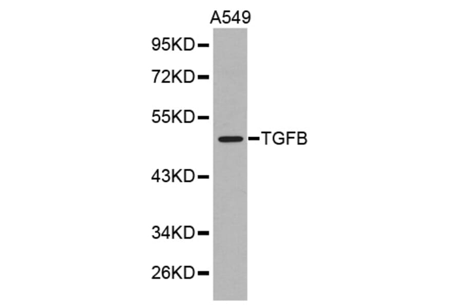 Western blot - TGFB1 antibody from Signalway Antibody (38371) - Antibodies.com