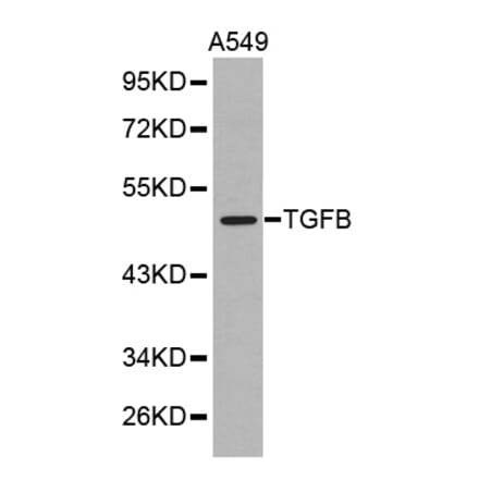 Western blot - TGFB1 antibody from Signalway Antibody (38371) - Antibodies.com