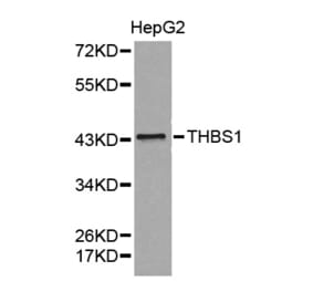 Western blot - THBS1 antibody from Signalway Antibody (38372) - Antibodies.com
