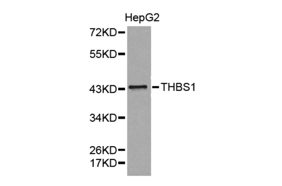 Western blot - THBS1 antibody from Signalway Antibody (38372) - Antibodies.com