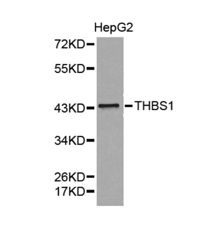 Western blot - THBS1 antibody from Signalway Antibody (38372) - Antibodies.com