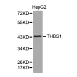 Western blot - THBS1 antibody from Signalway Antibody (38372) - Antibodies.com