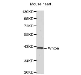 Western blot - Wnt5a antibody from Signalway Antibody (38376) - Antibodies.com