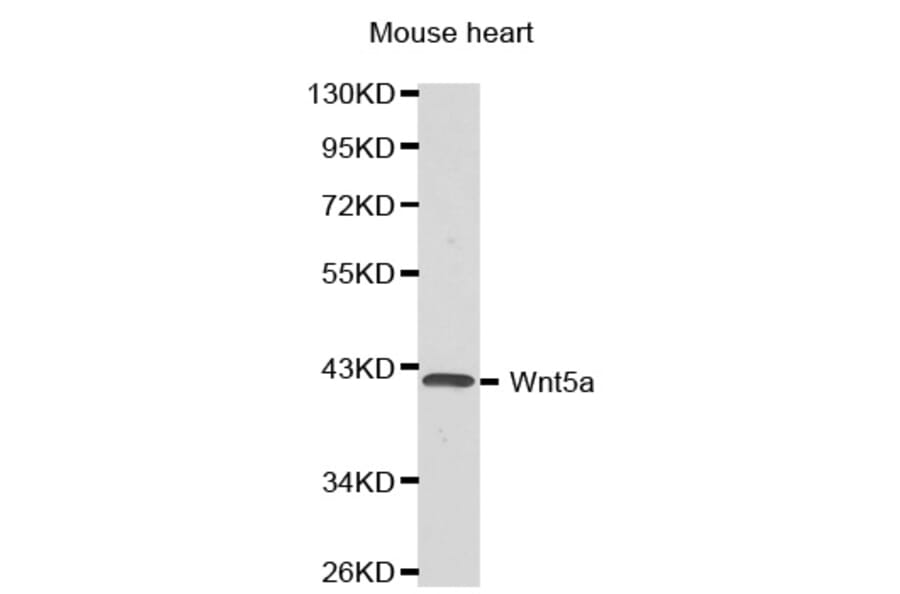 Western blot - Wnt5a antibody from Signalway Antibody (38376) - Antibodies.com