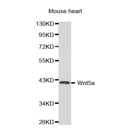 Western blot - Wnt5a antibody from Signalway Antibody (38376) - Antibodies.com