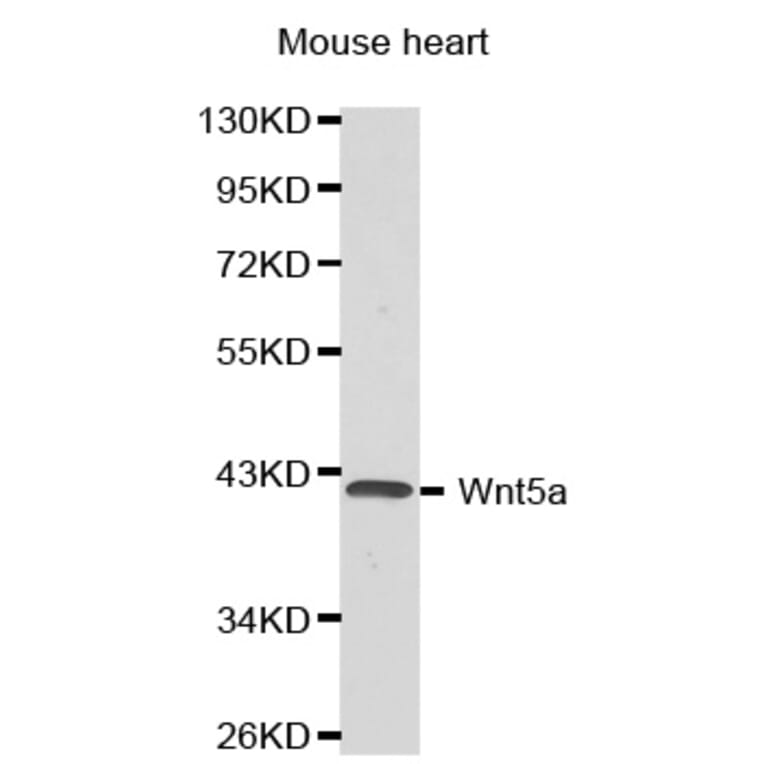 Western blot - Wnt5a antibody from Signalway Antibody (38376) - Antibodies.com