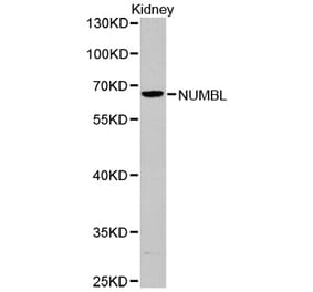 Western blot - NUMBL antibody from Signalway Antibody (38379) - Antibodies.com