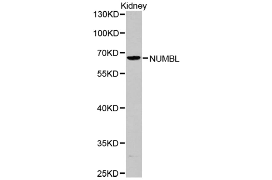 Western blot - NUMBL antibody from Signalway Antibody (38379) - Antibodies.com