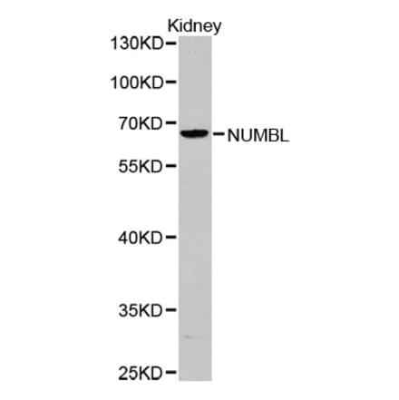 Western blot - NUMBL antibody from Signalway Antibody (38379) - Antibodies.com