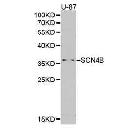 Western blot - SCN4B antibody from Signalway Antibody (38386) - Antibodies.com