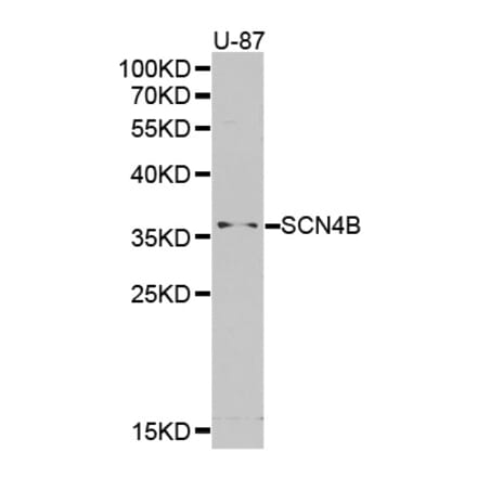 Western blot - SCN4B antibody from Signalway Antibody (38386) - Antibodies.com