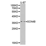 Western blot - SCN4B antibody from Signalway Antibody (38386) - Antibodies.com
