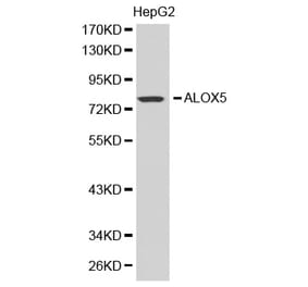 Western blot - ALOX5 antibody from Signalway Antibody (38389) - Antibodies.com