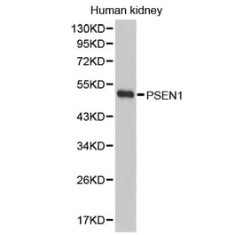 Western blot - PSEN1 antibody from Signalway Antibody (38395) - Antibodies.com