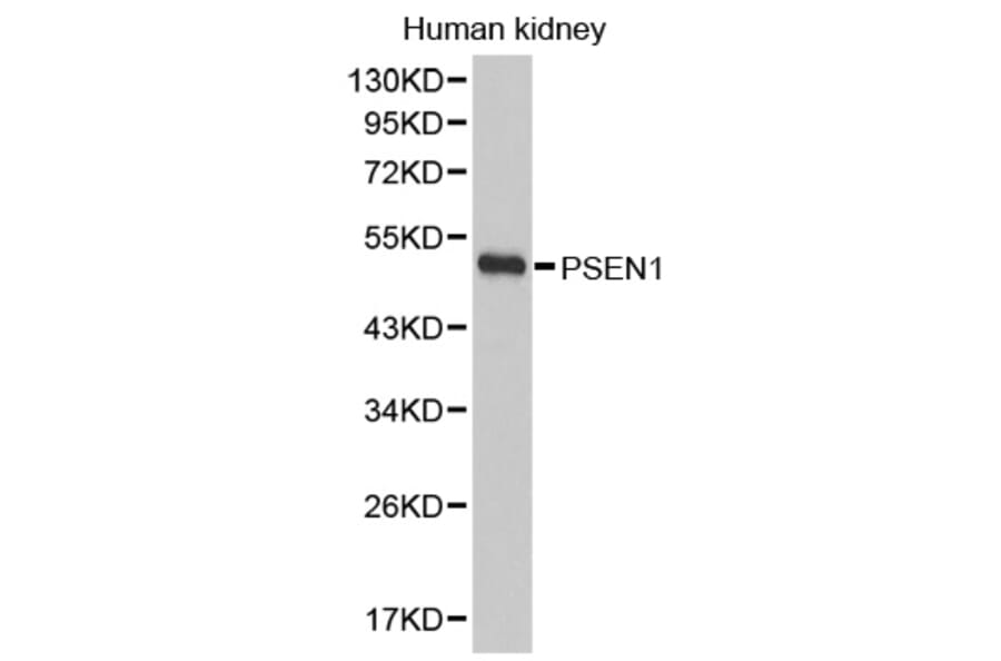Western blot - PSEN1 antibody from Signalway Antibody (38395) - Antibodies.com
