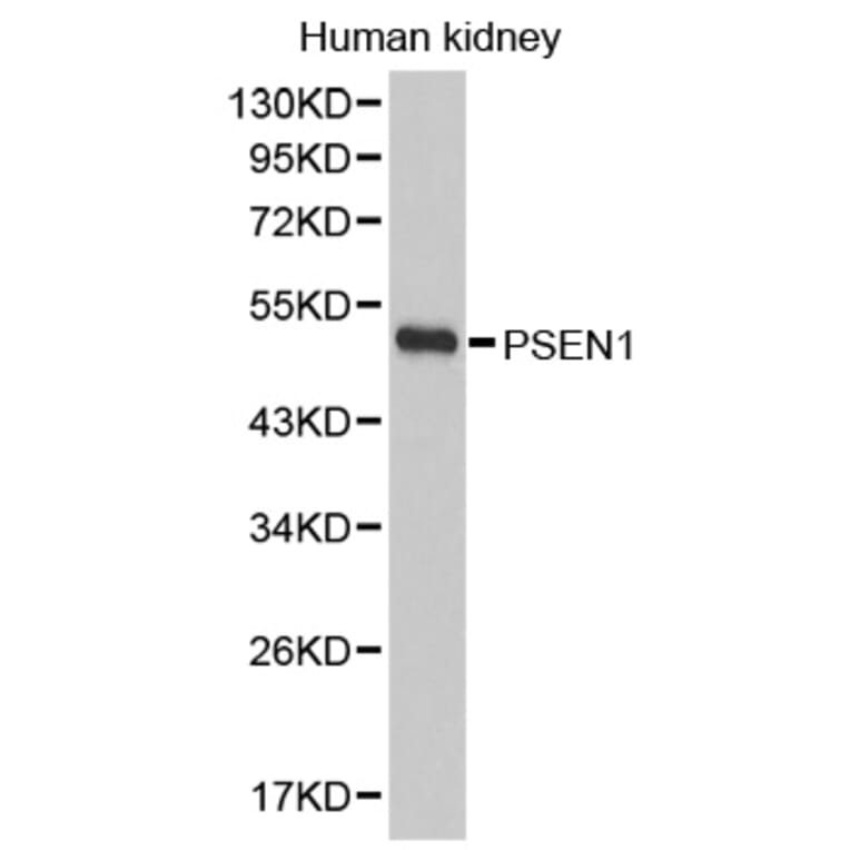 Western blot - PSEN1 antibody from Signalway Antibody (38395) - Antibodies.com