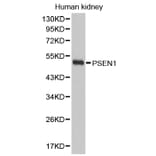 Western blot - PSEN1 antibody from Signalway Antibody (38395) - Antibodies.com