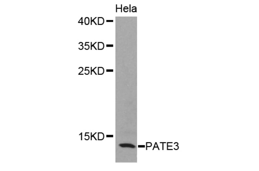 Western blot - PATE3 antibody from Signalway Antibody (38398) - Antibodies.com
