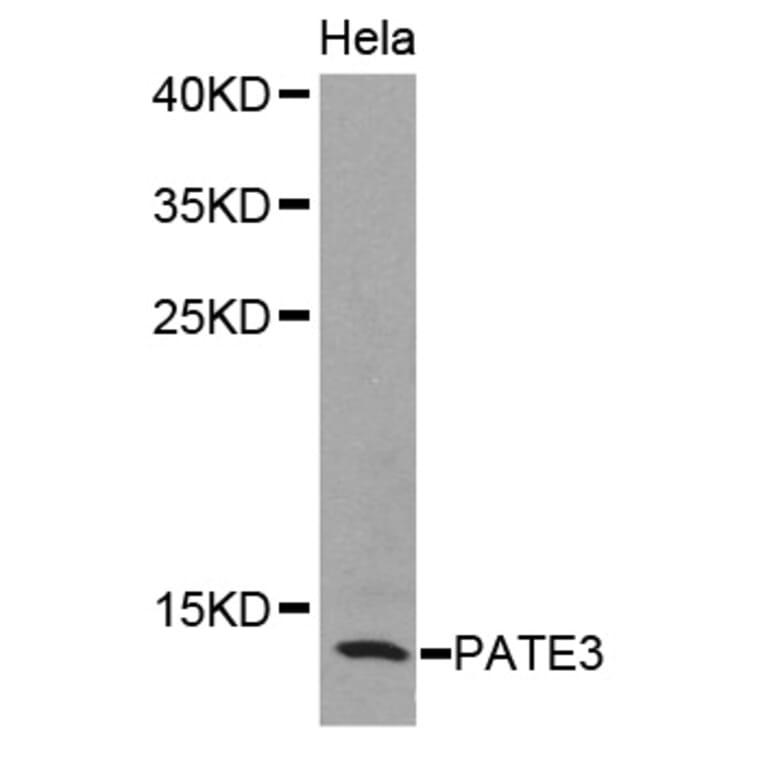 Western blot - PATE3 antibody from Signalway Antibody (38398) - Antibodies.com