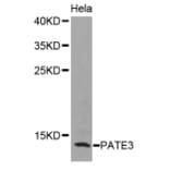 Western blot - PATE3 antibody from Signalway Antibody (38398) - Antibodies.com