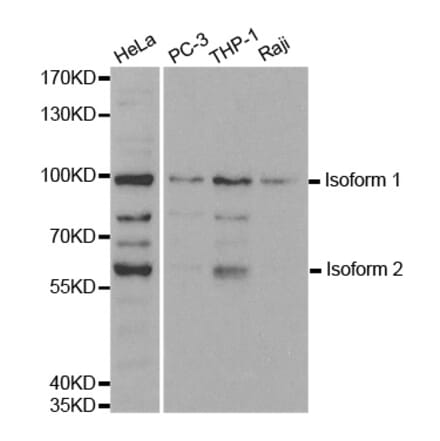 Western blot - UHRF2 antibody from Signalway Antibody (38400) - Antibodies.com