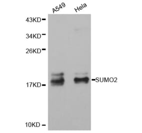 Western blot - SUMO2 antibody from Signalway Antibody (38405) - Antibodies.com