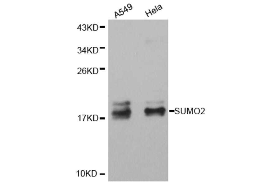 Western blot - SUMO2 antibody from Signalway Antibody (38405) - Antibodies.com