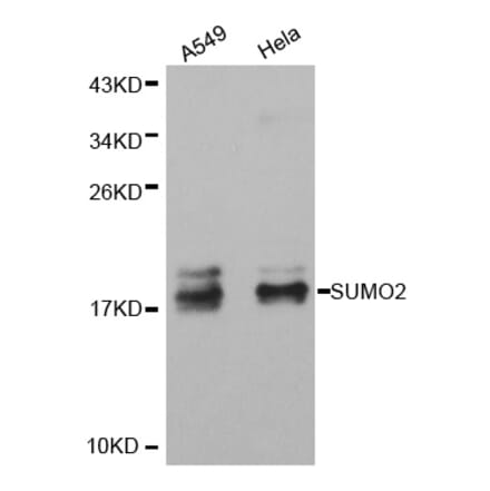 Western blot - SUMO2 antibody from Signalway Antibody (38405) - Antibodies.com