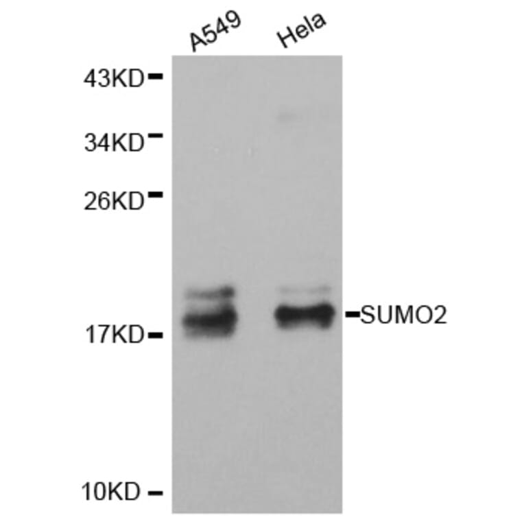 Western blot - SUMO2 antibody from Signalway Antibody (38405) - Antibodies.com