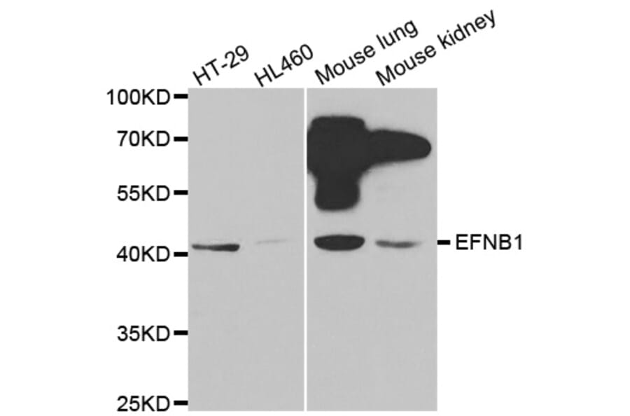 Western blot - EFNB1 antibody from Signalway Antibody (38414) - Antibodies.com