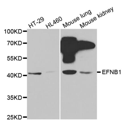 Western blot - EFNB1 antibody from Signalway Antibody (38414) - Antibodies.com