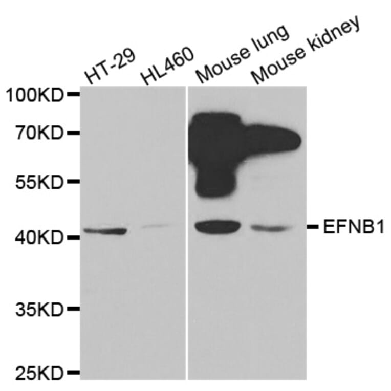 Western blot - EFNB1 antibody from Signalway Antibody (38414) - Antibodies.com