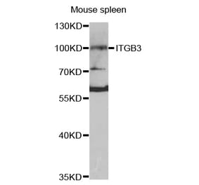 Western blot - ITGB3 antibody from Signalway Antibody (38420) - Antibodies.com