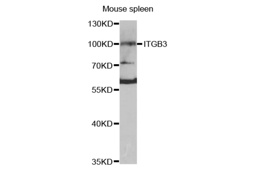 Western blot - ITGB3 antibody from Signalway Antibody (38420) - Antibodies.com