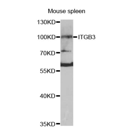 Western blot - ITGB3 antibody from Signalway Antibody (38420) - Antibodies.com