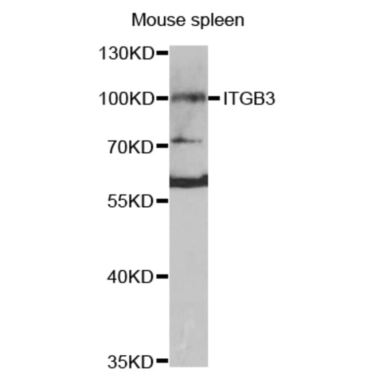 Western blot - ITGB3 antibody from Signalway Antibody (38420) - Antibodies.com