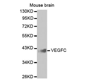 Western blot - VEGFC antibody from Signalway Antibody (38425) - Antibodies.com