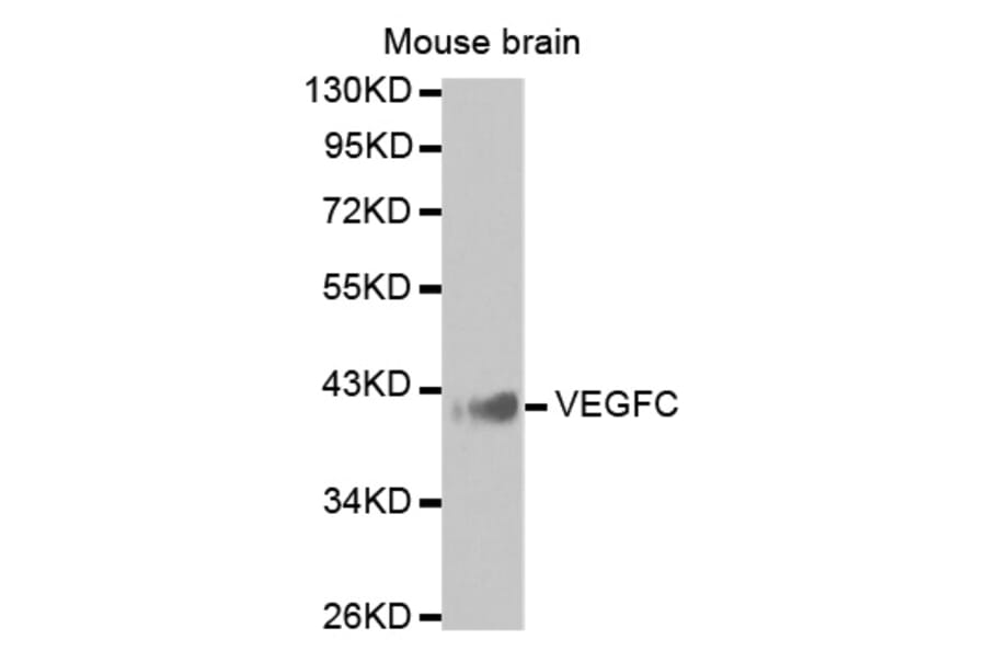 Western blot - VEGFC antibody from Signalway Antibody (38425) - Antibodies.com