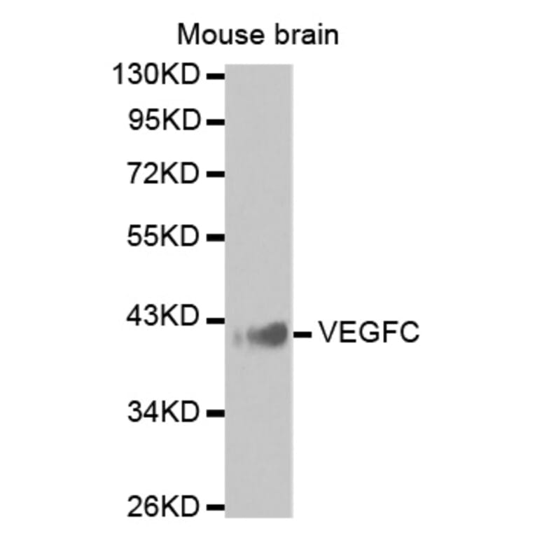 Western blot - VEGFC antibody from Signalway Antibody (38425) - Antibodies.com