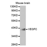 Western blot - VEGFC antibody from Signalway Antibody (38425) - Antibodies.com