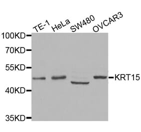 Western blot - KRT15 antibody from Signalway Antibody (38433) - Antibodies.com