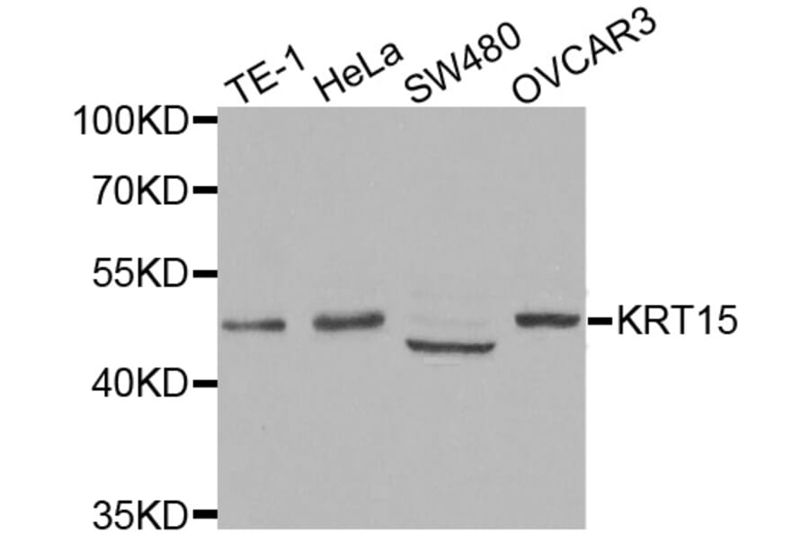 Western blot - KRT15 antibody from Signalway Antibody (38433) - Antibodies.com
